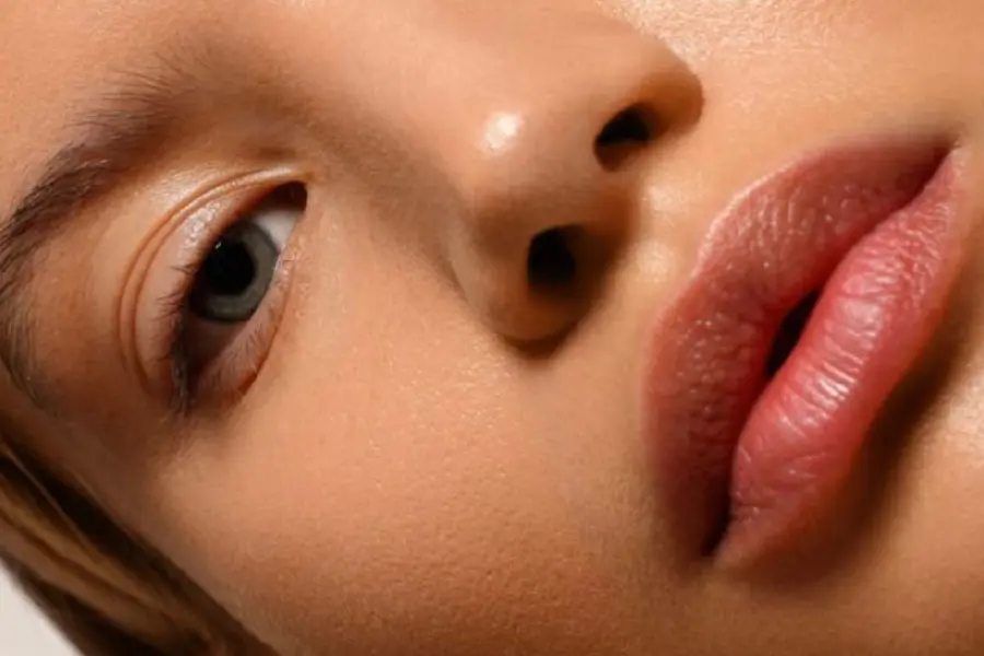 Representación de Acido Hialuronico en labios